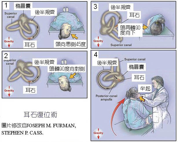 耳石症是什么病?和填色游戏有关系吗?