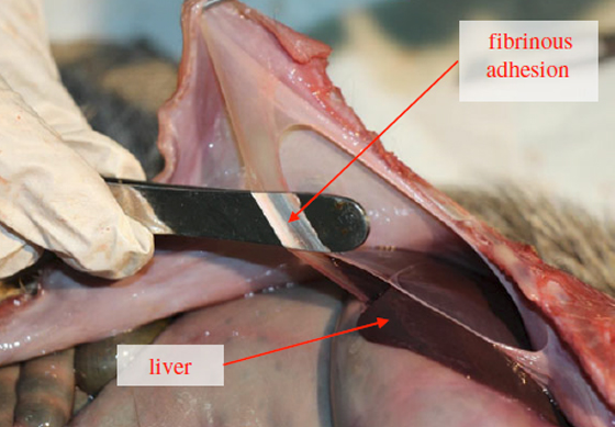 Fibrinous-adhesion.jpg