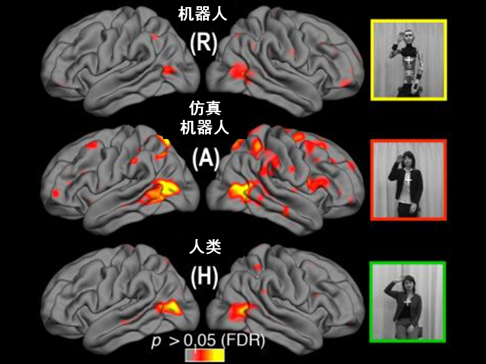 三种类型的刺激激活的大脑皮层相关区域结果图。
