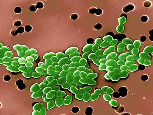 图集:10大抗药细菌坏头目